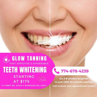 Teeth whitening