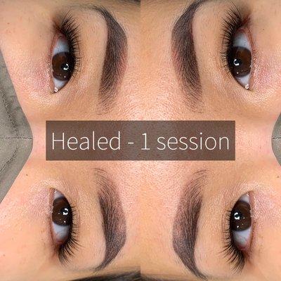 Healed combination brow