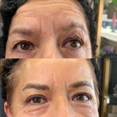 Eyebrow Microblading for a younger looking face