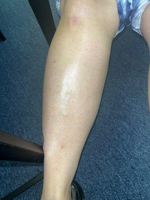 After leg wax