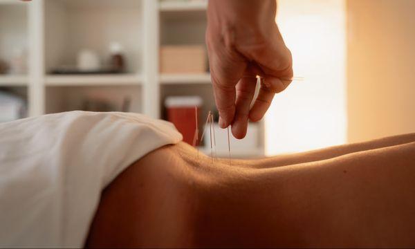 Melida Acupuncture