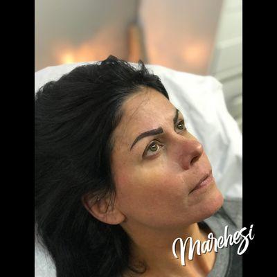 Microblading