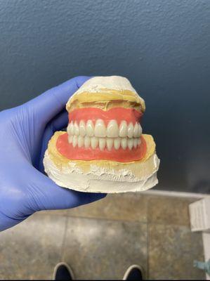 Full upper & lower dentures