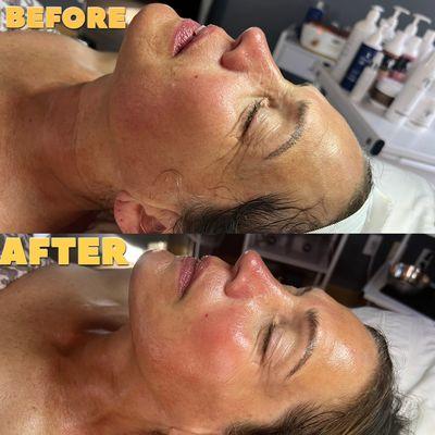 Firm and LIft Facial: Tightening, Lifting and Hydrated Glow!