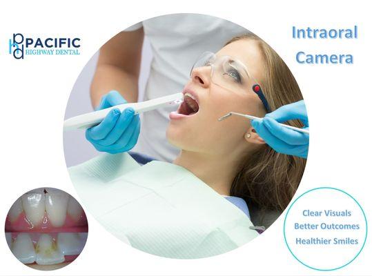 Intraoral Camera - details matter!