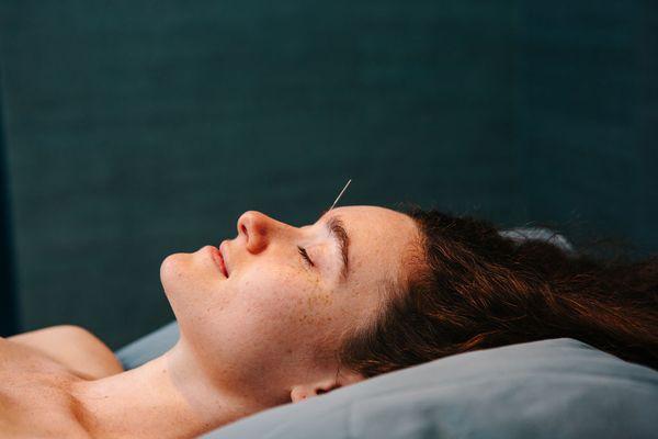 Acupuncture treats pain and induces relaxation.