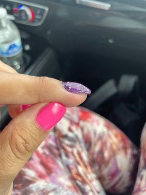 Look how thick the purple nail is, it's gross