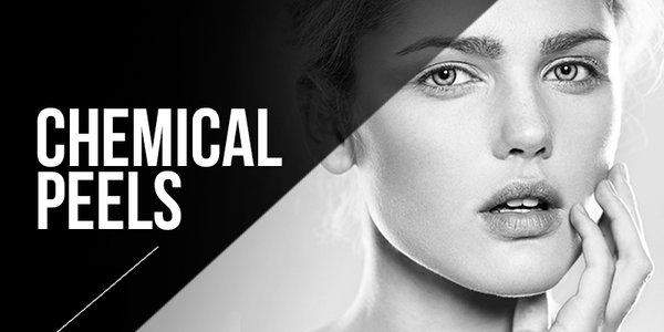 Chemical Peels