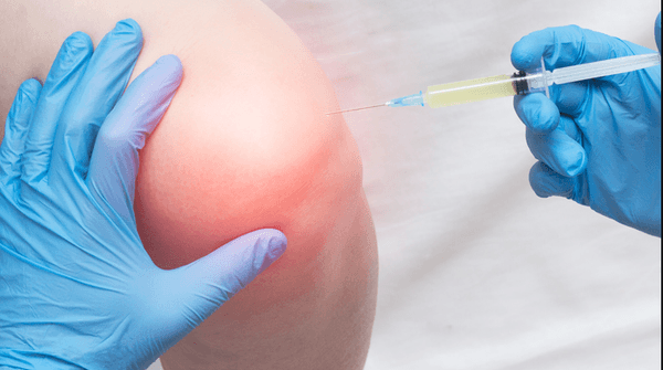 prp or platelet rich plasma for sports injuries and soft tissue like meniscus and inflammation