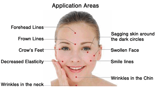 Cosmetic Acupuncture