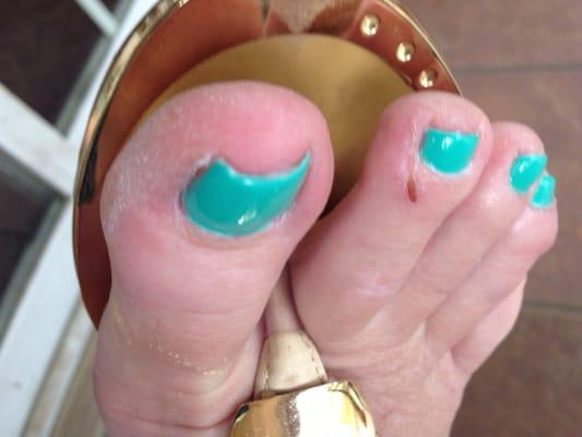 Couldn't even cut my toenails even!