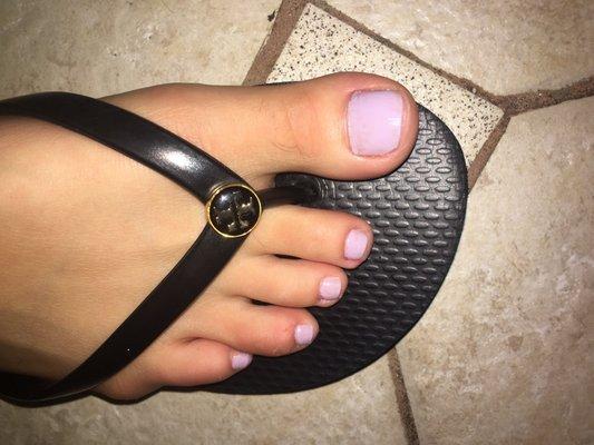 My uneven toe lol