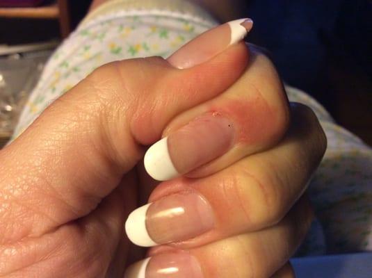 Shellack French manicure, one day later. Raw cuticles from sander.