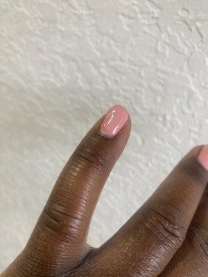 Lumpy, poorly polished nails that are chipping.