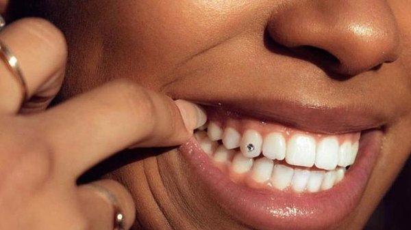 Teeth whitening/ Gem services