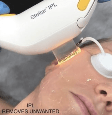 Eye treatments