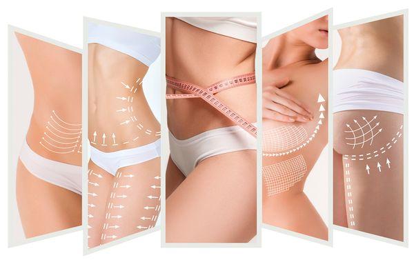 Get bikini ready with Strawberry Laser Lipo