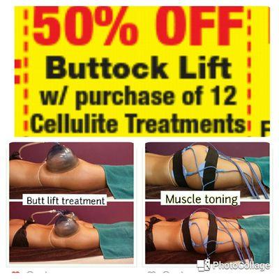 Cellulite Reduction Treatment with Buttocks Lift