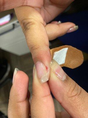 Finger they cut