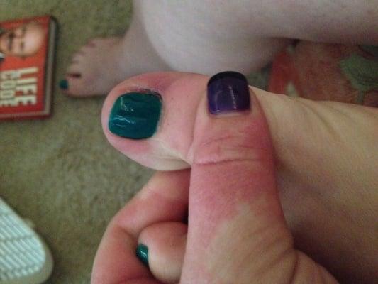 They cut my big toe nail slanted. They literally cut the side off of my nail making it totally lopsided.