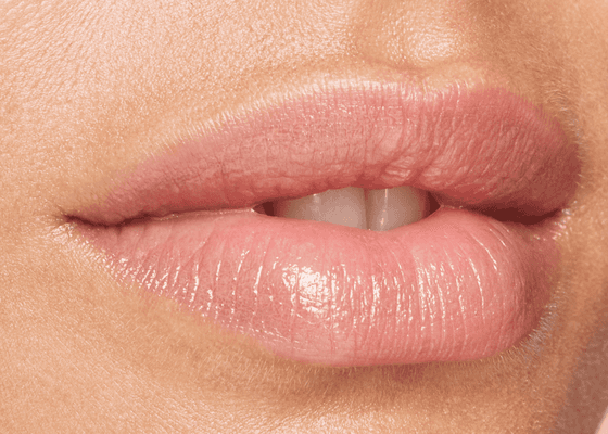 Lip fillers