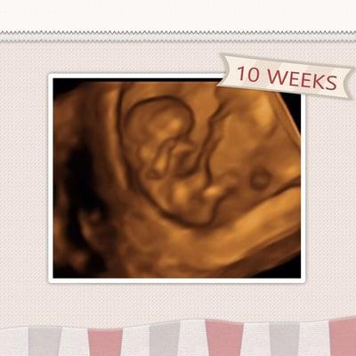 10 weeks in 4D!