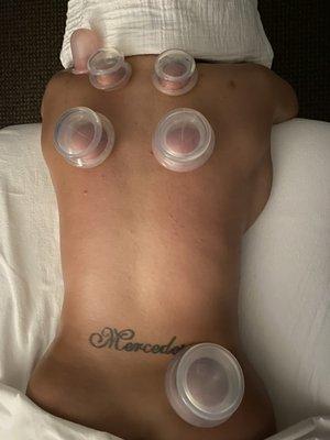 Cupping