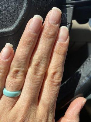 Uneven filed nails