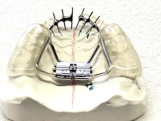 Lawson Dental Lab, LLC