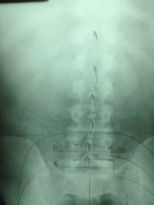 X-ray