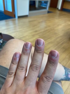 Terrible manicure, cuticle not cut, nails not buffed.