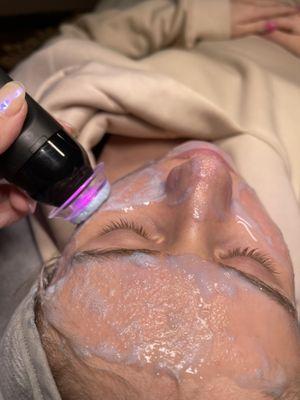 Glo2 Facial Oxfoliation. 
Oxygenation + Exfoliation