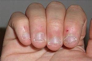 If your nails look like this. You need me.