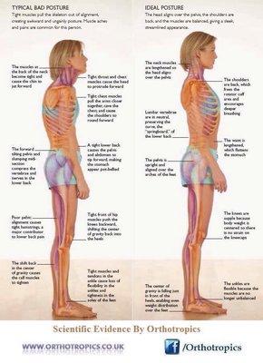 Postural Corrections & Muscle Imbalances