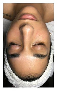 Cielo facial