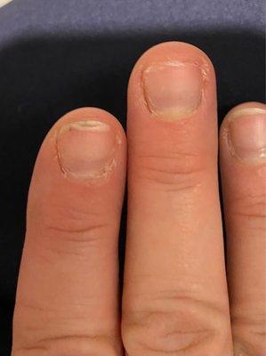 Condition of my nails three weeks after manicure.