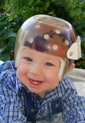 Zack sporting his camo cranial remolding helmet.