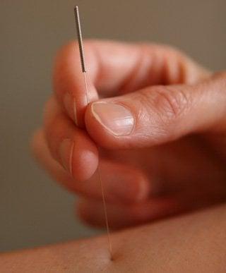 Acupuncture and Traditional Chinese Medicine are used to treat pain, infertility, and many other common health ailments.