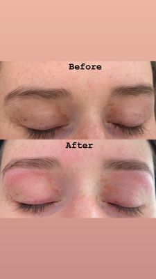 Eyebrow threading before and after