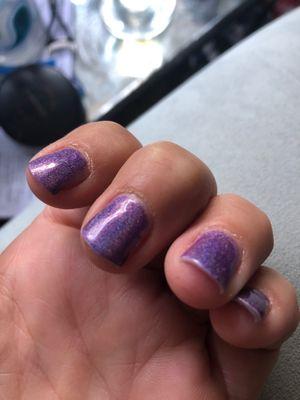 Another example of poor cuticles