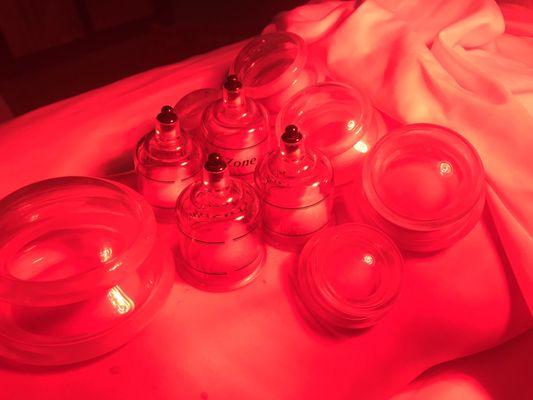 Cupping + infrared heat over the lumbar area helps to alleviate tight muscles and tension in the low back. This treatment is very relaxing.