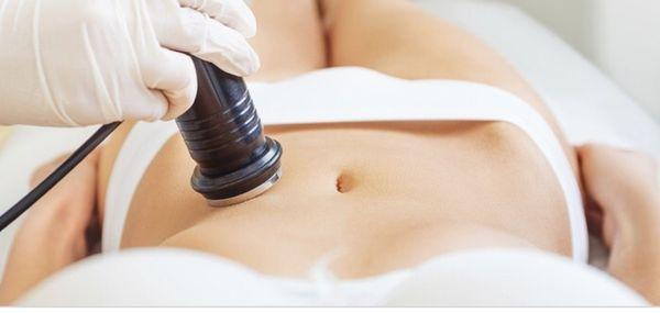 Ultrasonic Cavitation