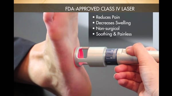 Painless K-Laser for Fungal Nails, and Plantar Fasciitis and Neuropathy