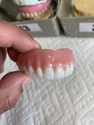 Almost burned my fingers, this Full Upper Denture was fire!