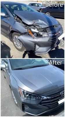 2016 Hyundai ELANTRA front end damage restored to brand new