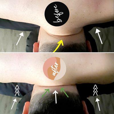 Before and after of a massage session showing improvements made..