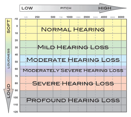 Audiogram - An Audiogram is a Hearing Map that will show you where your hearing loss is...