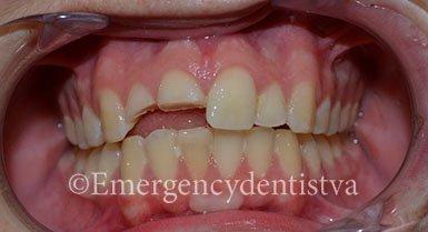 Emergency Dental Services