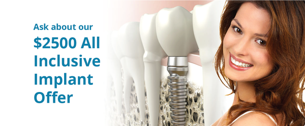 Dental implants are titanium artificial tooth roots that replace missing teeth while preserving the jawbone.