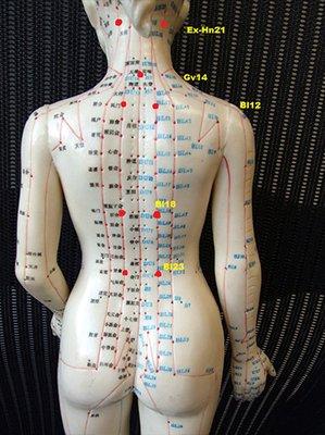 Meridians on the body. Mondi use this knowledge to help her clients by putting #Cups on it to open up the blockages.